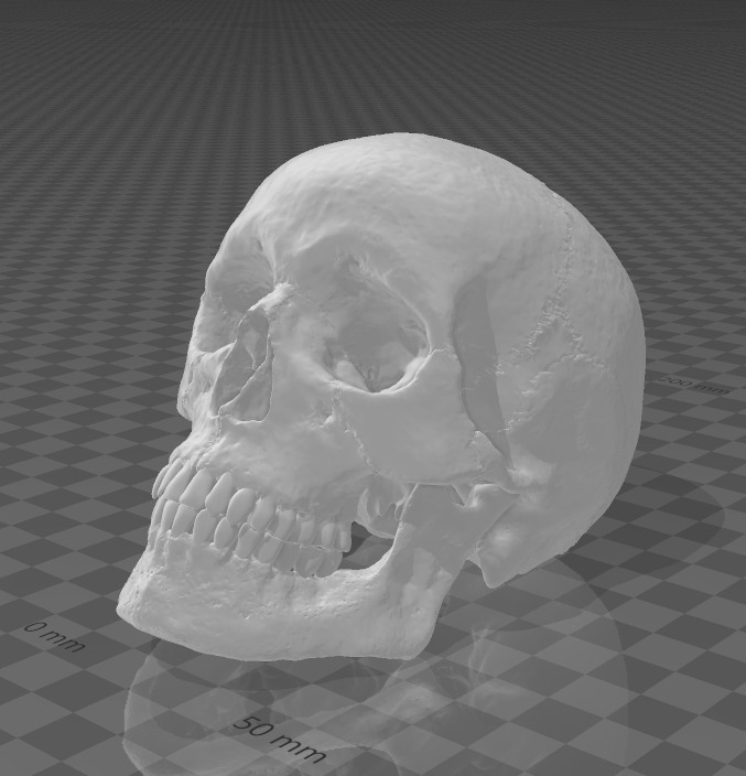 Human Skull resin inclusion