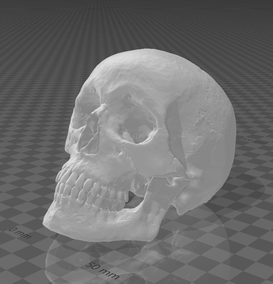 Human Skull resin inclusion